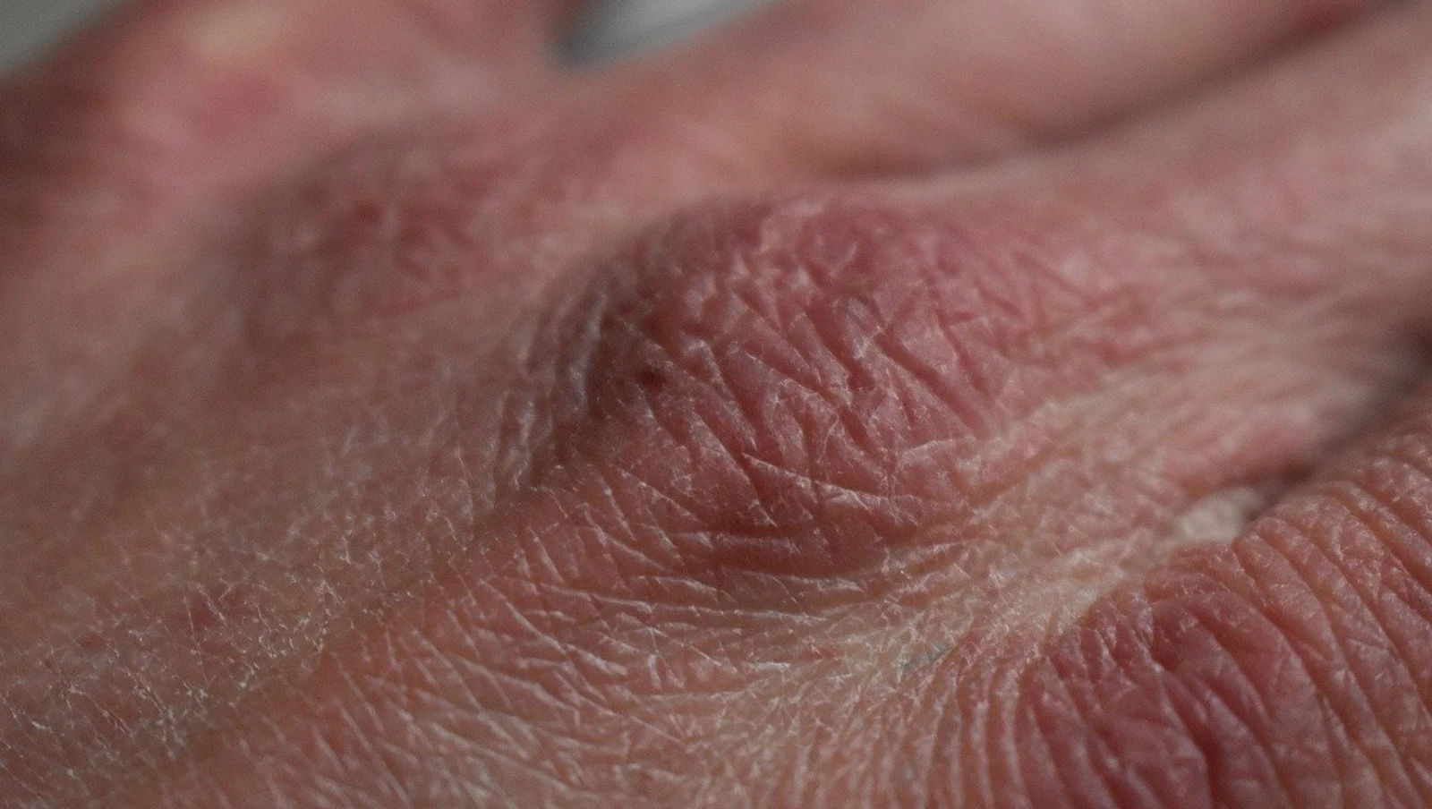 How To Know If You're Dehydrated.