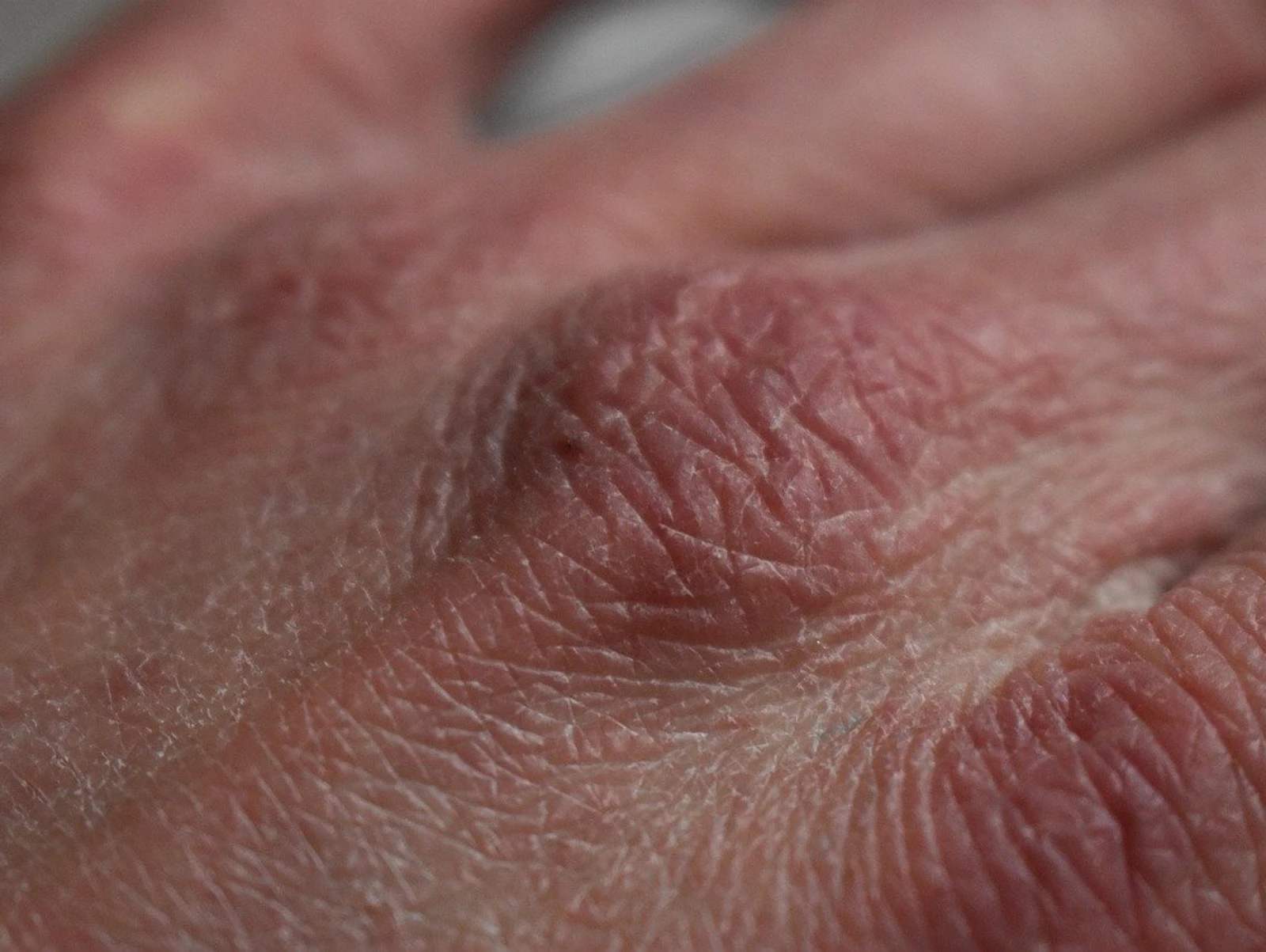 How To Know If You're Dehydrated.