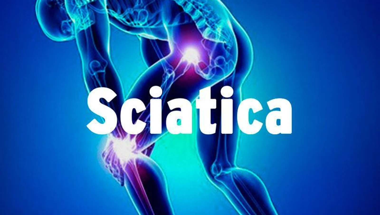 How Do I Know If I Have Sciatica? This Simple Test Can Tell You